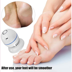 Appareil Électrique Anti-Callosités – Éliminateur de Peaux Mortes pour les Pieds